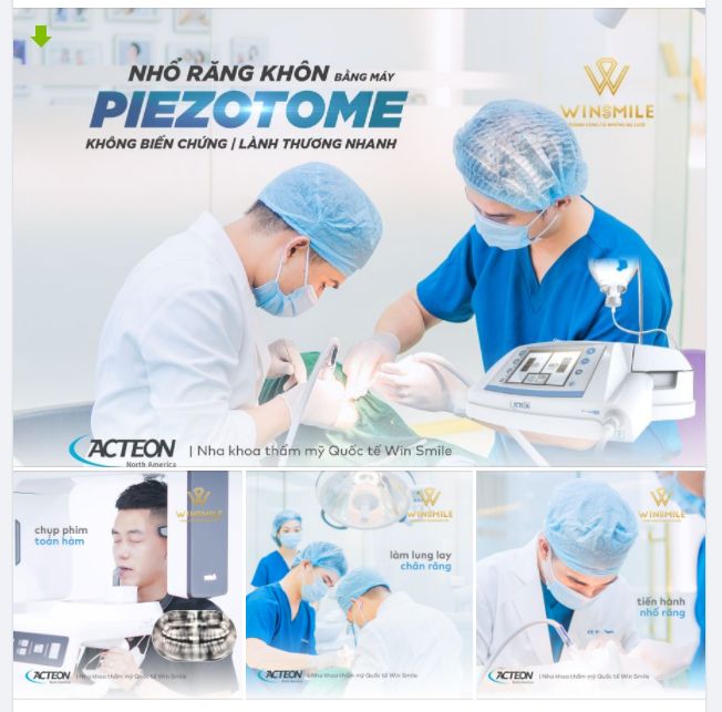 NHỔ RĂNG KHÔN BẰNG PIEZOTOME KHÔNG ĐAU - KHÔNG BIẾN CHỨNG - LÀNH THƯƠNG NHANH