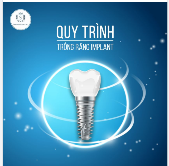 Quy trình Trồng răng Implant tại Shinbi Dental