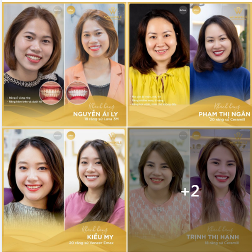 Sự thay đổi của khách hàng là minh chứng rõ nhất đối với một dịch vụ nha khoa.