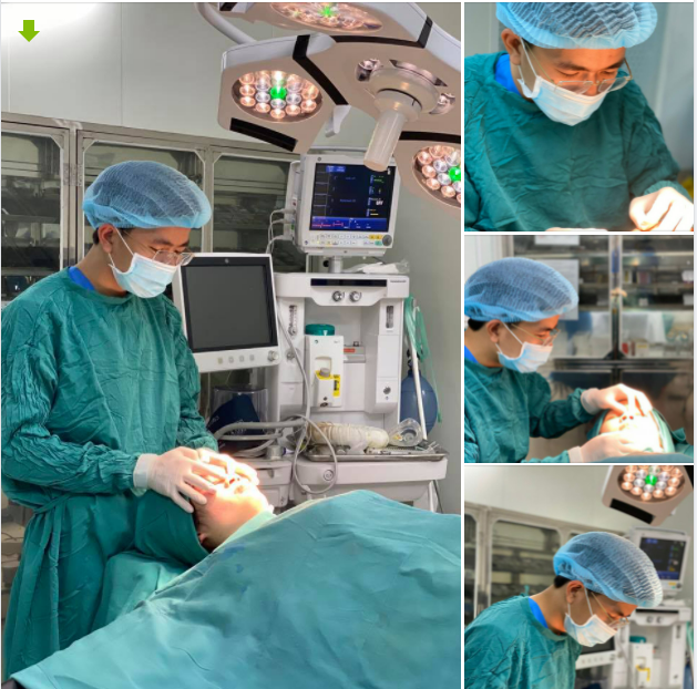 Chào tháng mới với ca nâng mũi cấu trúc cho chị khách hàng từ Nam Định.