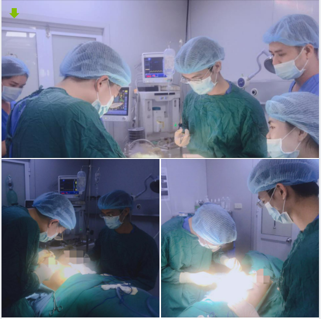 Ca nâng ngực thành công tại Dr Ngọc Trung sáng nay 