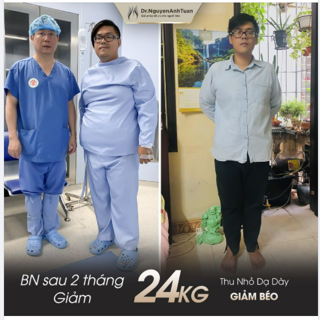 Giảm 24kg sau 2 tháng thực hiện Thu nhỏ Dạ dày - Giảm béo