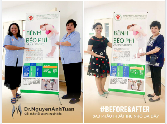 "Giảm béo - Thu nhỏ Dạ dày" kết hợp với một Chế độ dinh dưỡng hợp lý – Hoạt động thể chất điều độ - Cân bằng lối sống lành mạnh giúp bạn có một vóc dáng cân đối và một sức khỏe tốt