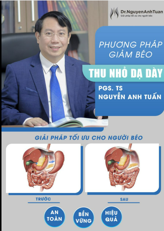 Phương pháp Thu nhỏ Dạ dày Giảm béo giúp bạn giảm cân như thế nào?