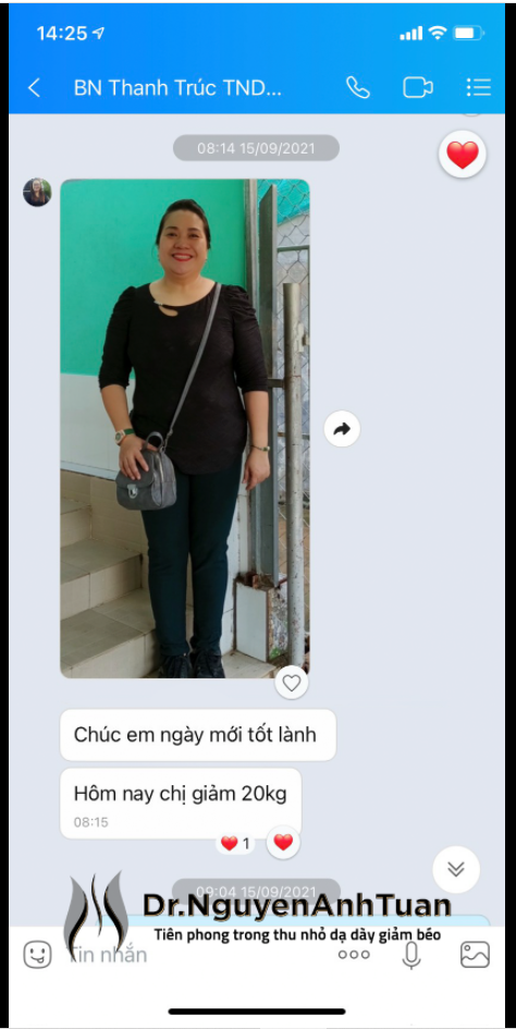 Sau 2,5 tháng thực hiện Thu nhỏ Dạ dày bệnh nhân giảm 20kg