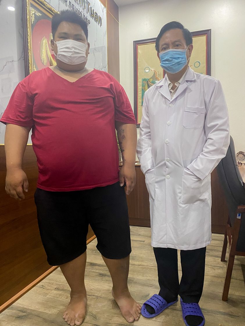 Cơ chế điều trị bệnh Béo phì của phương pháp phẫu thuật nội soi Thu nhỏ Dạ dày