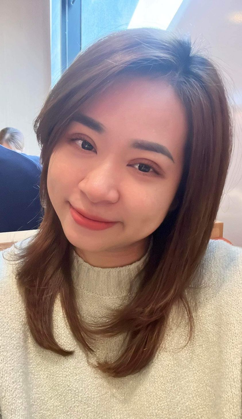 Khách hàng cắt mí sau 2 tuần