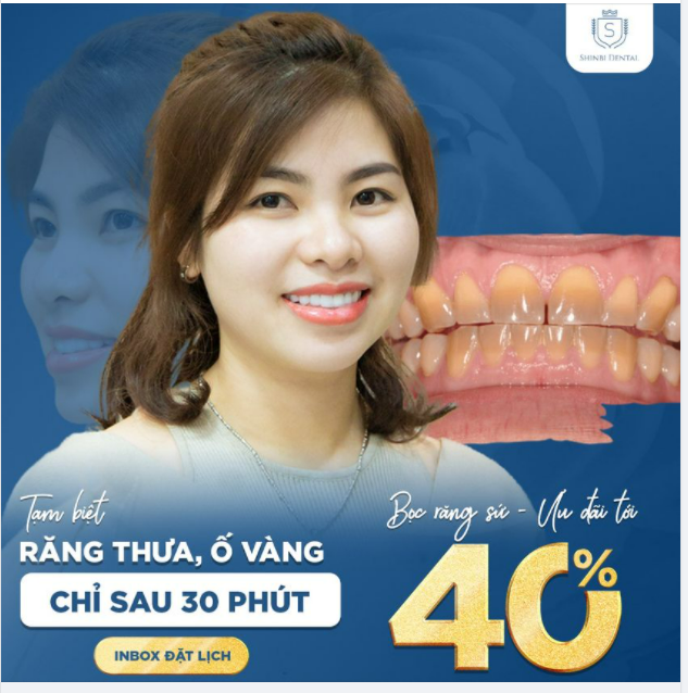 BỌC RĂNG SỨ KHÔNG MÀI RĂNG - CHỈ CÓ TẠI NHA KHOA SHINBI DENTAL!
