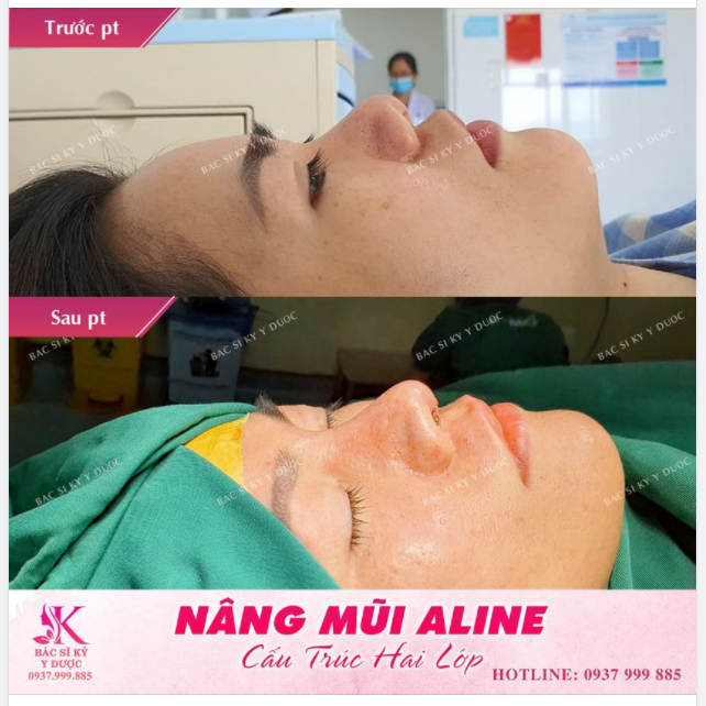 Dáng ALINE cao thanh cho em gái chuẩn bị lên xe hoa.