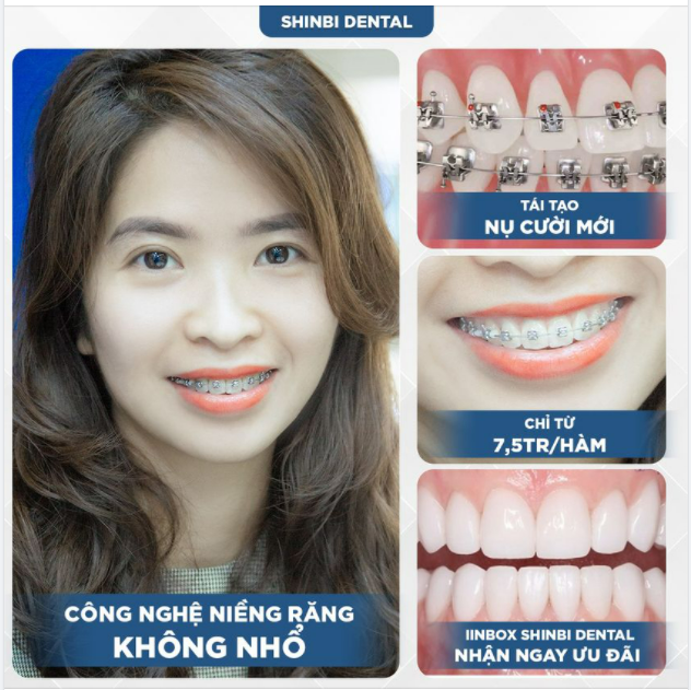 Nhổ răng có phải là nỗi lo sợ lớn nhất của các bạn mỗi khi đi niềng