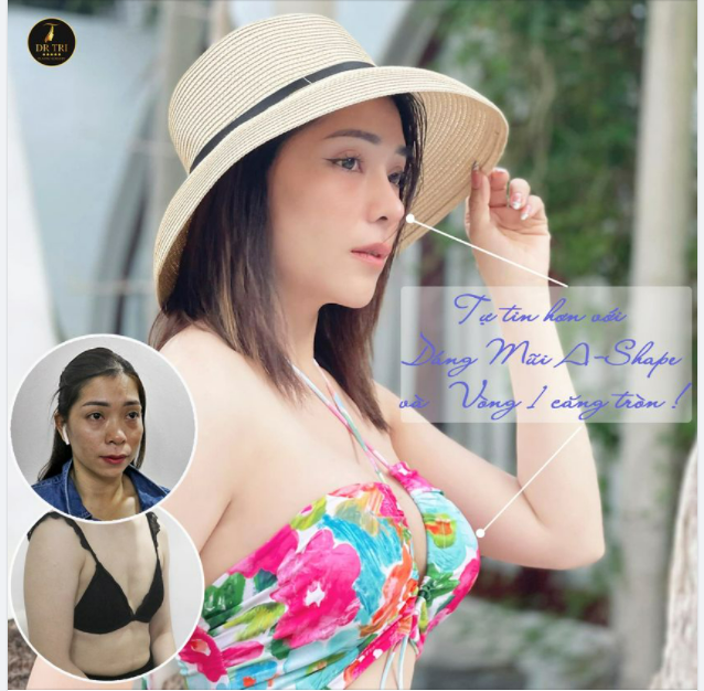 TỪ MŨI THẤP NGỰC LÉP ĐẾN NÀNG THƠ THANH TÚ, THU HÚT