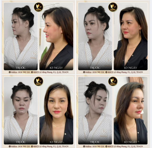 Bí quyết gìn giữ nét xuân là đây chứ đâu!
