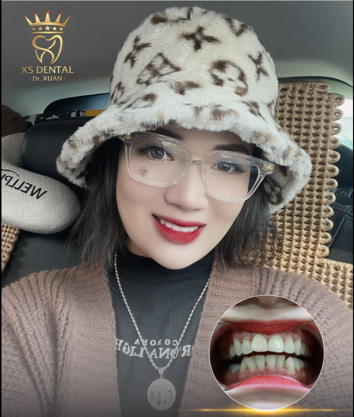 Chỉ cần bạn dám thay đổi, ngoại hình của bạn sẽ thăng hạng ngay tức thì nhờ có nụ cười trắng sáng, đều đẹp.