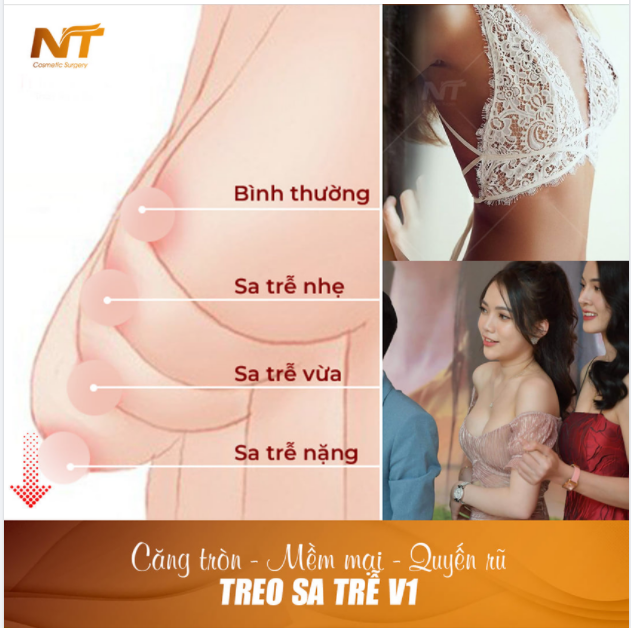 Chỉ từ 45.000.000 - Căng tròn quyến rũ