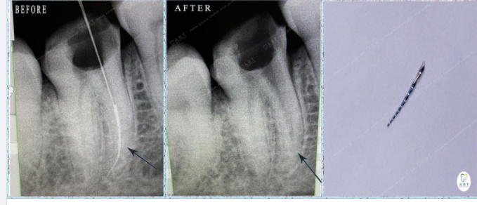 Đã nhiều lần mình tự hỏi, Art dentist chuyên cứu net cho đồng nghiệp