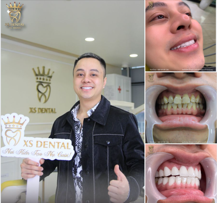 ĐÁNH THỨC BẢN LĨNH VỚI NỤ CƯỜI NAM TÍNH, CHUẨN TỰ NHIÊ