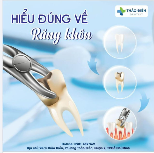 Hiểu về răng khôn