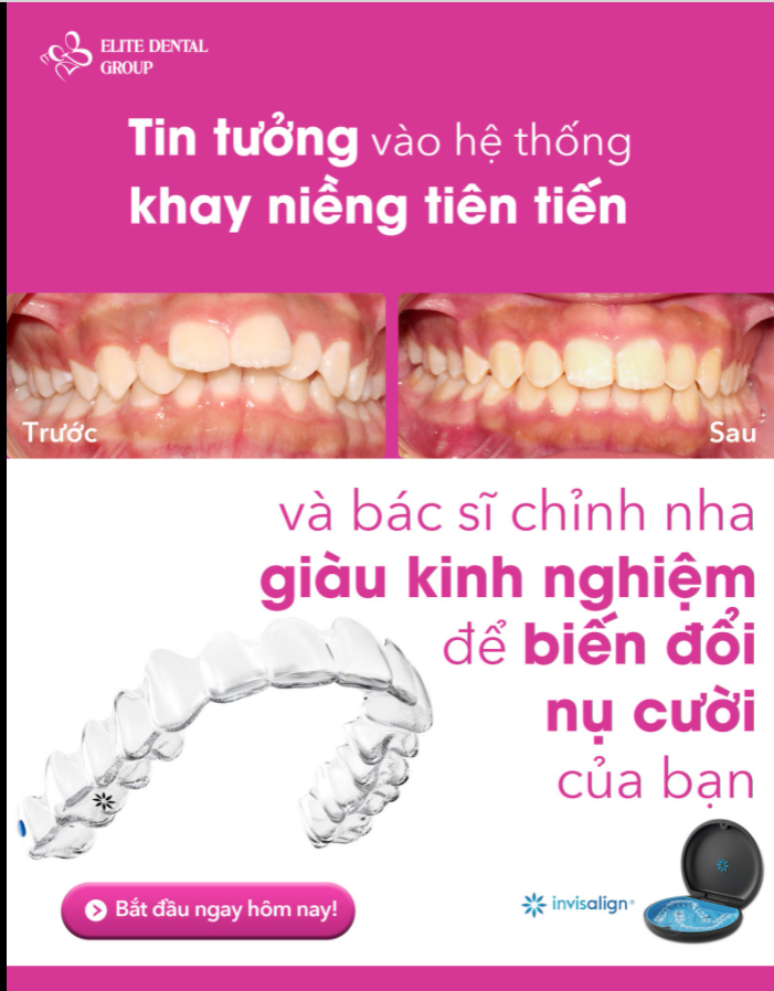 INVISALIGN VỚI CA CẮN SÂU, RĂNG HÔ VÀ KHẤP KHỂNH