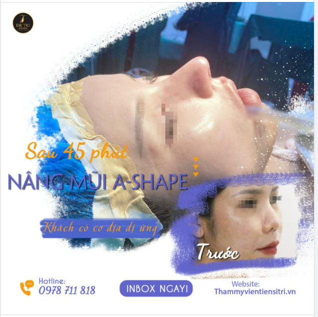 KHÁCH CƠ ĐỊA KHÓ - ĐÃ CÓ DR.TRÍ LO!