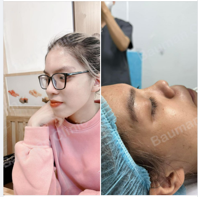 Mũi cấu trúc nhà làm