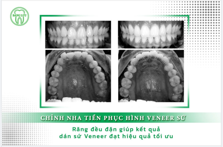 Nha Khoa Đăng Lưu – Ưu ái nụ cười