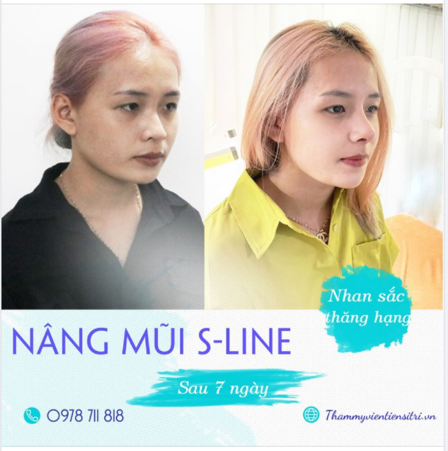 THĂNG HẠNG NHAN SẮC CHỈ SAU 7 NGÀY