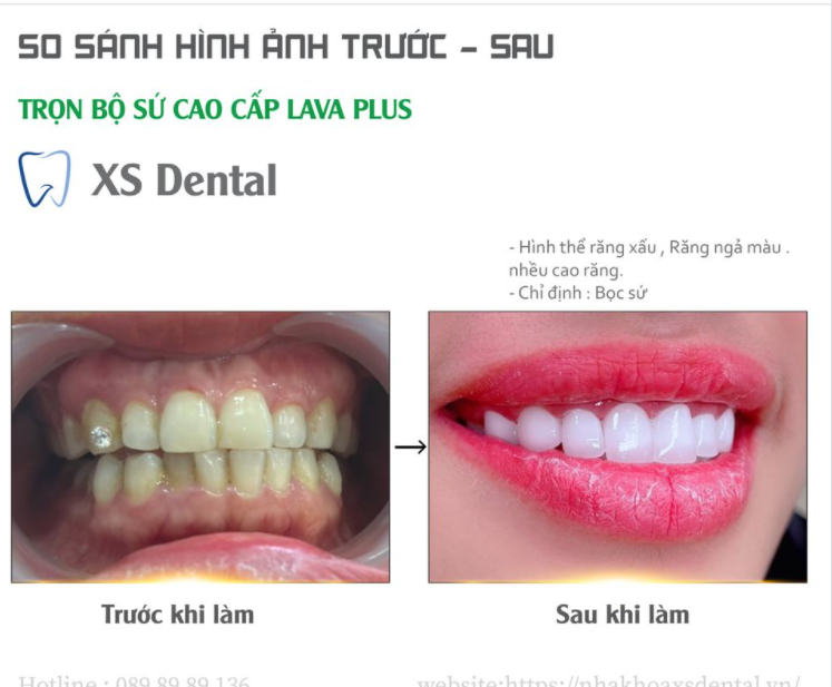 THAY ĐỔI NỤ CƯỜI - TƯƠI MỚI DIỆN MẠO