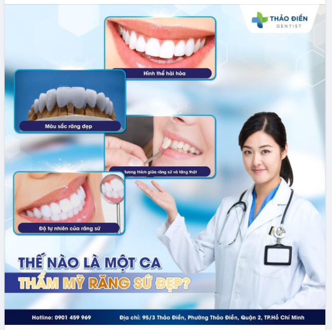 THẾ NÀO LÀ MỘT CA THẨM MỸ RĂNG SỨ ĐẸP