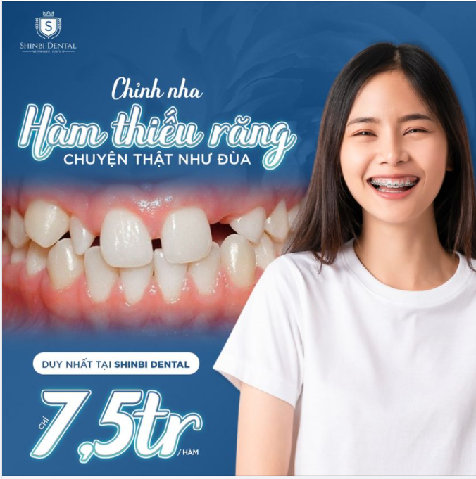 THIẾU RĂNG BẨM SINH CÓ NIỀNG RĂNG ĐƯỢC KHÔNG?