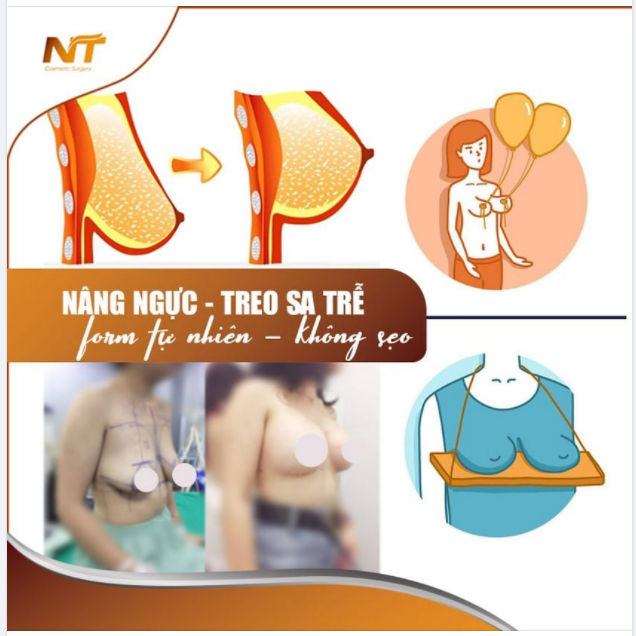 Trợ giá 10.000.000 - Chị em treo sa trễ kết hợp đặt túi