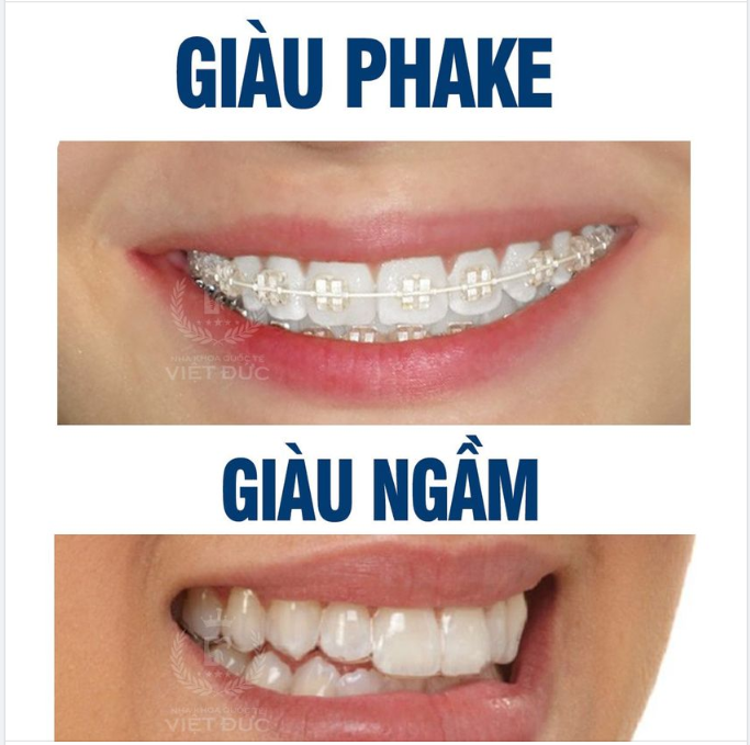 Cách nhận biết người giàu 