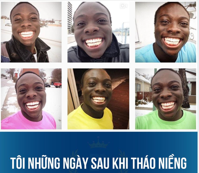 Một nụ cười tự tin