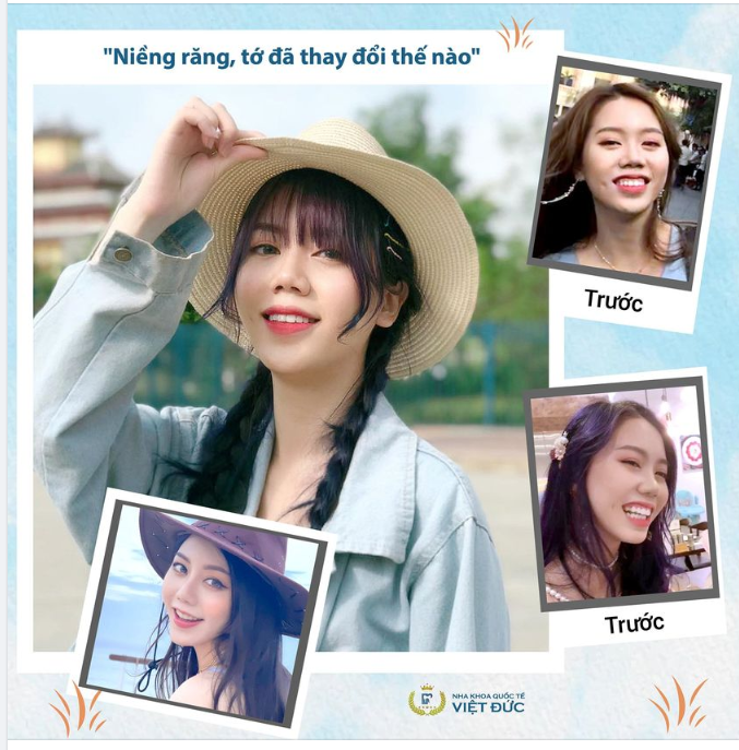 NIỀNG RĂNG ĐÃ THAY ĐỔI BẠN THẾ NÀO