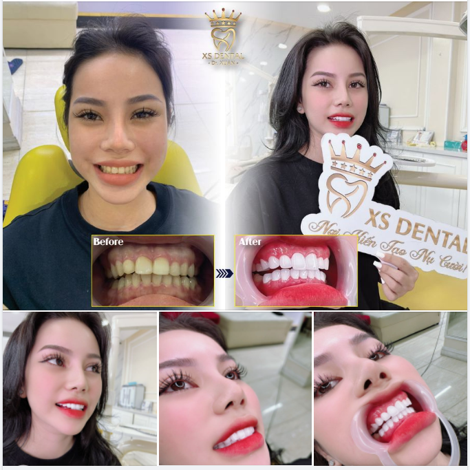 NỤ CƯỜI TỎA NẮNG - LAN TỎA NĂNG LƯỢNG CHO MỘT NGÀY LÀM VIỆC HIỆU QUẢ