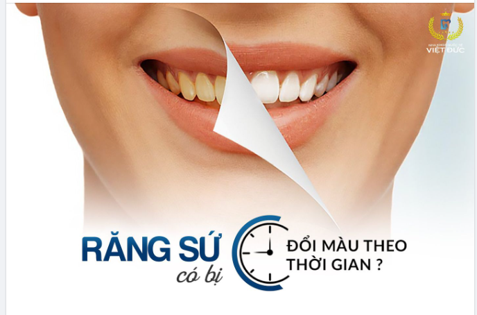 RĂNG SỨ CÓ BỊ ĐỔI MÀU THEO THỜI GIAN
