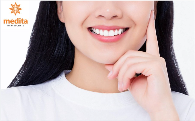 03 YẾU TỐ TẠO NÊN MỘT NỤ CƯỜI ĐẸP