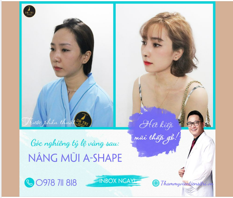 DÁNG MŨI A-SHAPE MÃI ĐỈNH MẤY CHẾ ƠI!