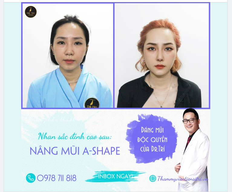 CHỈ CẦN THAY ĐỔI DÁNG MŨI, NHAN SẮC THĂNG HẠNG BẤT NGỜ!