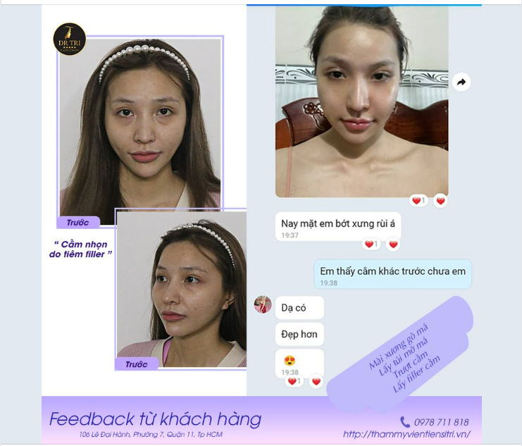 Feedback dễ thương của khách sau 5 ngày thực hiện dịch vụ