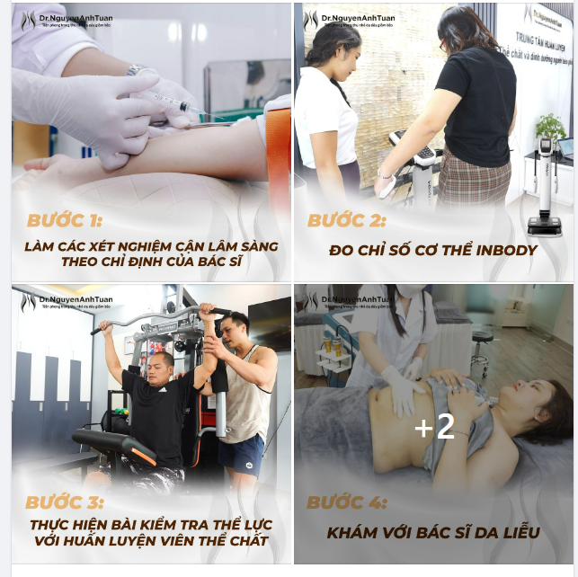 Quy trình Tái khám sau Thu nhỏ Dạ dày giảm béo