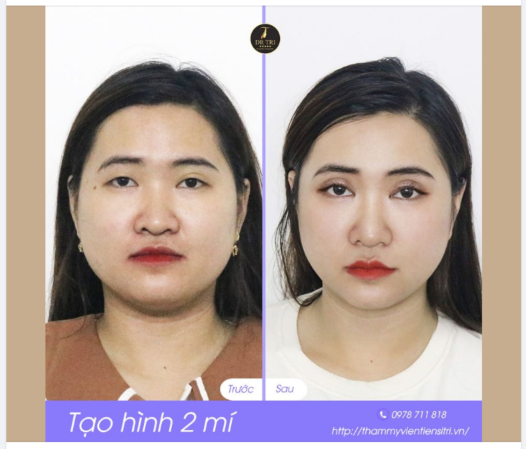 ĐỔI DÁNG MẮT- SÁNG GƯƠNG MẶT