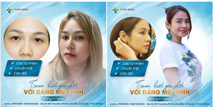 TẠM BIỆT GÓC CHẾT VỚI DÁNG MŨI XINH