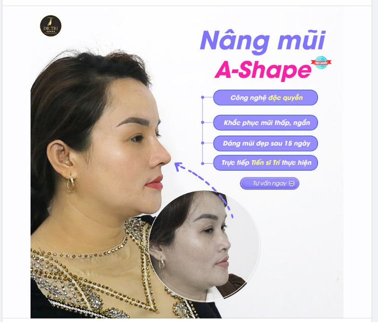 THAY DÁNG MŨI, ĐẸP GƯƠNG MẶT, VẬN HANH THÔNG