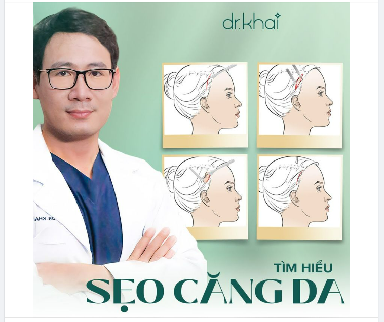 CĂNG DA MẶT CÓ ĐỂ LẠI SẸO KHÔNG