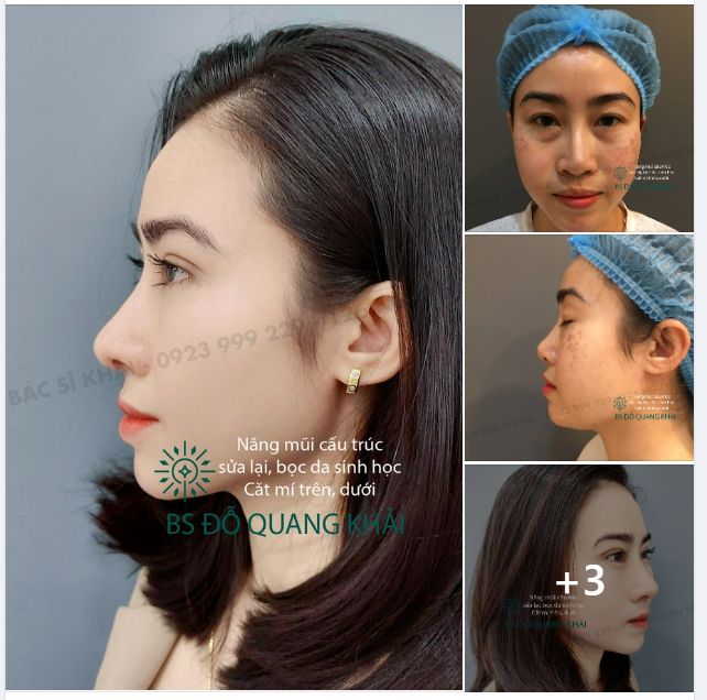 MÊ MẨN VỚI COMBO MỸ NHÂN