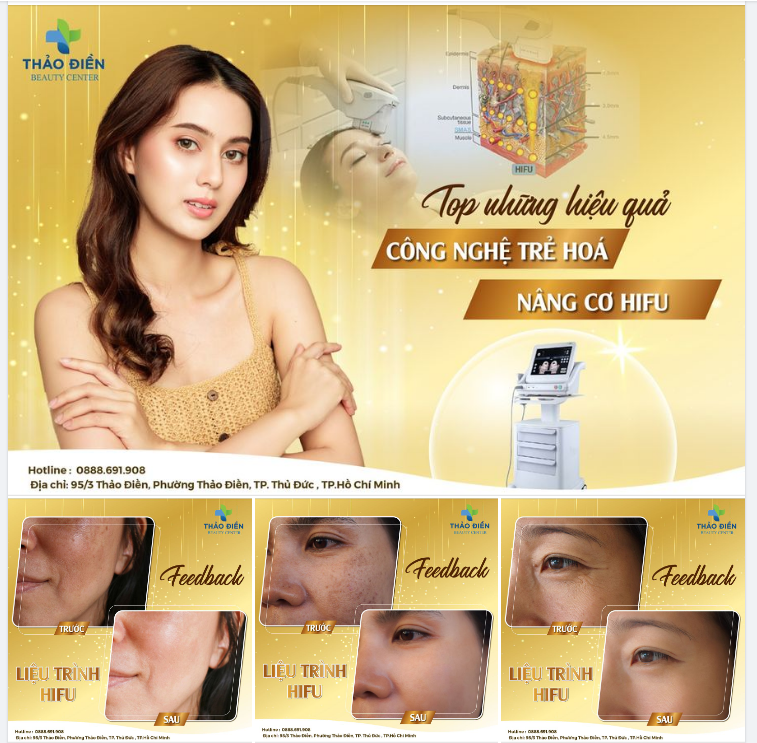 TOP NHỮNG HIỆU QUẢ NÂNG CƠ TRẺ HOÁ HIFU