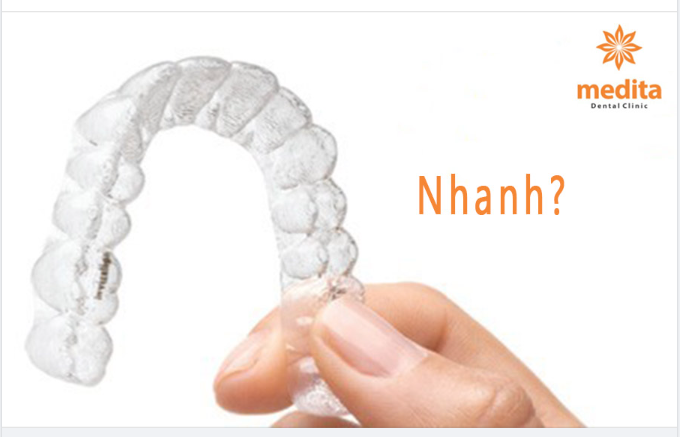 NIỀNG KHAY TRONG SUỐT NHANH HAY CHẬM?