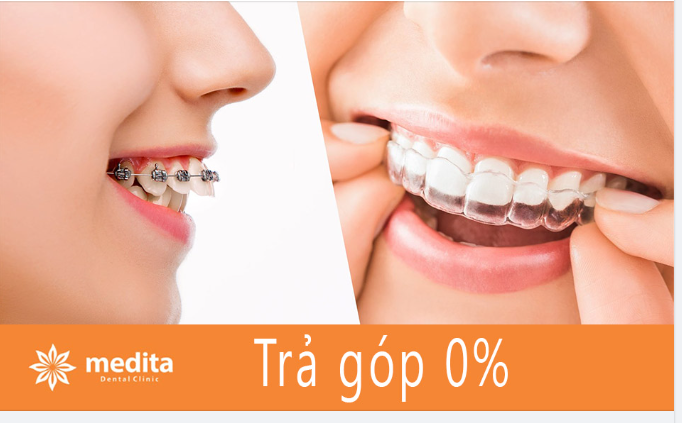 Nha khoa Thẩm mỹ Medita - Cười tự nhiên, duyên rạng ngời!