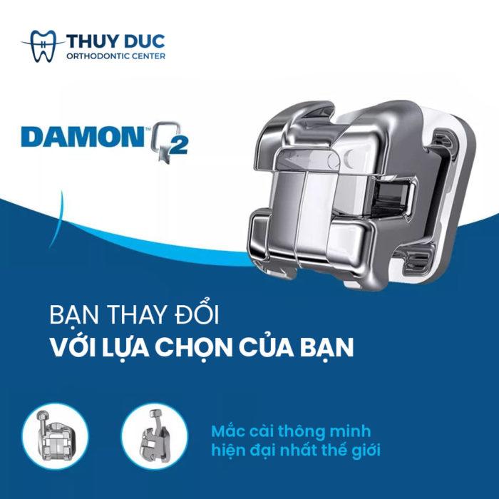 https://nhakhoathuyduc.com.vn/wp-content/uploads/2022/07/damon-q2-e1657116447222.jpg