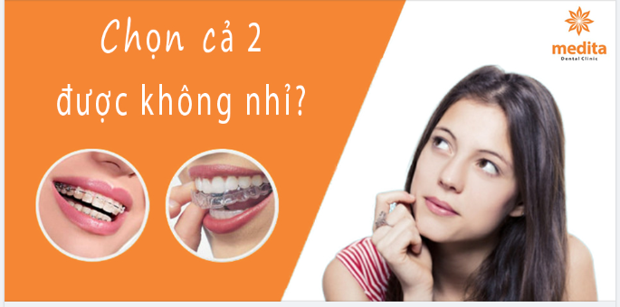 NIỀNG 2 HÀM 2 PHƯƠNG PHÁP ĐƯỢC KHÔNG?